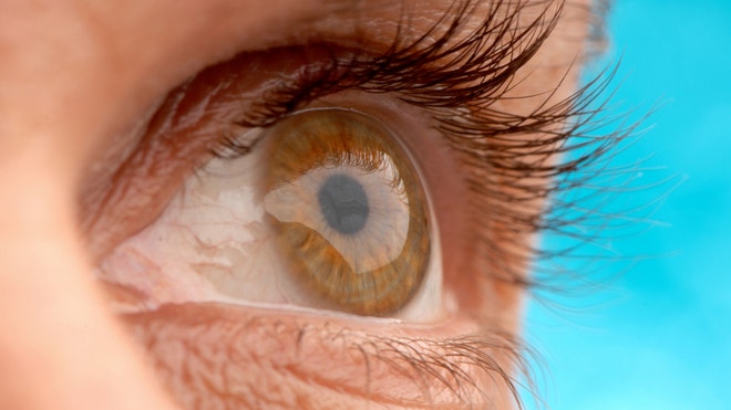 Man's eye.jpg